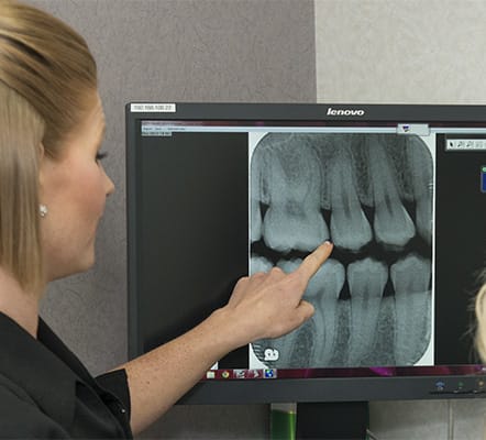 Digital X-Rays | Cornerstone Dentistry | Brantford Dentist